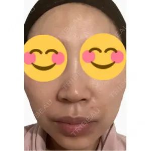 エルムクリニック 美容皮膚科エルムクリニック 麻布院口コミ