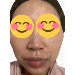 エルムクリニック 美容皮膚科エルムクリニック 麻布院口コミ