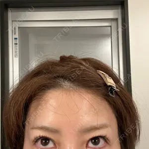 TCB東京中央美容外科 TCB東京中央美容外科 姫路院口コミ