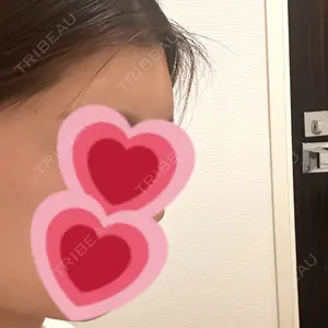 ギャラリークリニック ギャラリークリニック 銀座口コミ