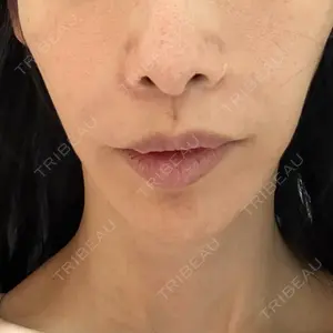 PRISM Beauty Clinic  PRISM Beauty Clinic 新宿院口コミ