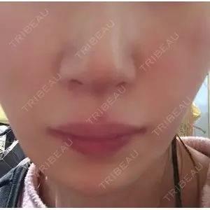 ヴェリテクリニック ヴェリテクリニック 銀座院口コミ