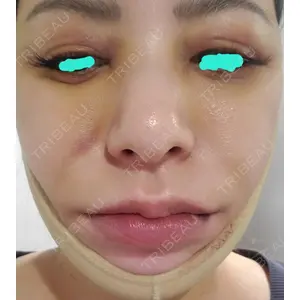 4Dクリニック口コミ