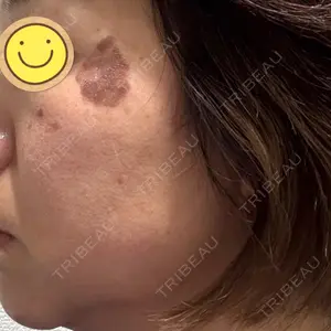 APスキンクリニック銀座口コミ