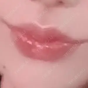 ルラ美容クリニック ルラ美容クリニック 大阪本院口コミ