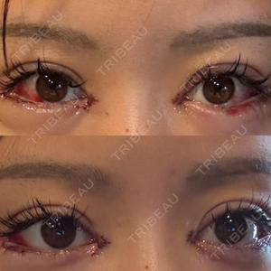 BITO BEAUTY CLINIC BITO BEAUTY CLINIC口コミ
