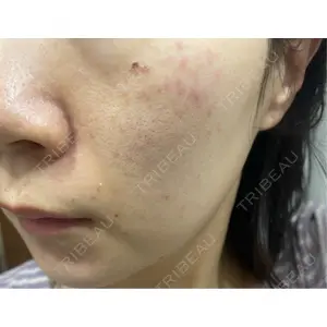 AURORA CLINIC（オーロラクリニック）新宿院口コミ