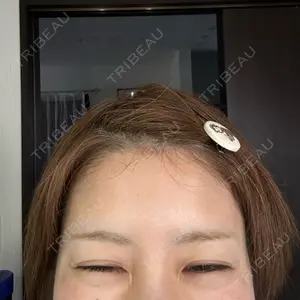 TCB東京中央美容外科 TCB東京中央美容外科 姫路院口コミ