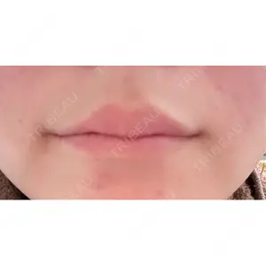 ルラ美容クリニック ルラ美容クリニック 大阪本院口コミ