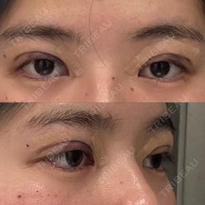 LUHO（ルホ）美容外科口コミ