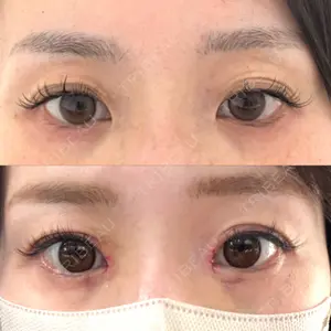 アイビークリニック 千葉美容外科アイビークリニック口コミ