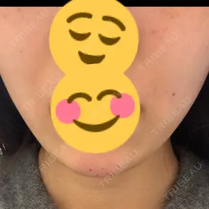 ルラ美容クリニック ルラ美容クリニック 池袋院口コミ