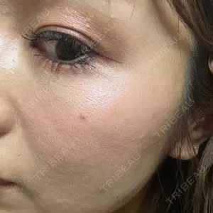 アネシス美容クリニック口コミ