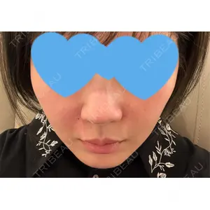口コミ