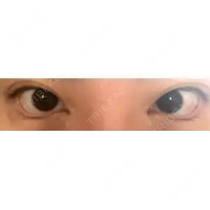 口コミ