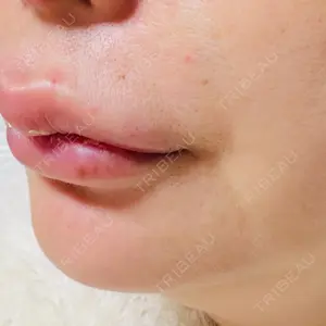 ルラ美容クリニック ルラ美容クリニック 大阪本院口コミ