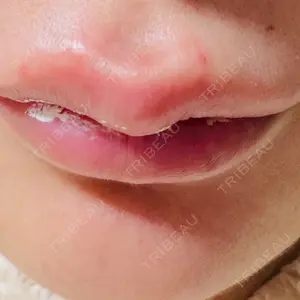 ルラ美容クリニック ルラ美容クリニック 大阪本院口コミ