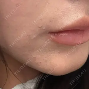 ビラビューティークリニック 博多美容外科/美容皮膚科 ビラビューティークリニック口コミ