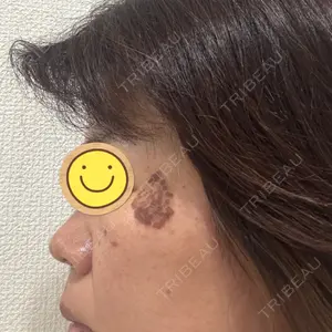 APスキンクリニック銀座口コミ