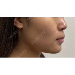 GRACY TOKYO CLINIC【グレイシートウキョウクリニック】口コミ