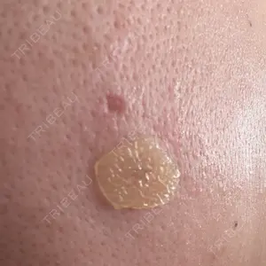 Fellez Clinic【フェルズクリニック】口コミ