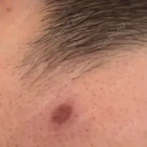 Fellez Clinic【フェルズクリニック】口コミ
