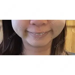 TCB東京中央美容外科 TCB東京中央美容外科 名古屋栄院口コミ