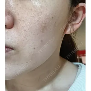 ビラビューティークリニック 博多美容外科/美容皮膚科 ビラビューティークリニック口コミ