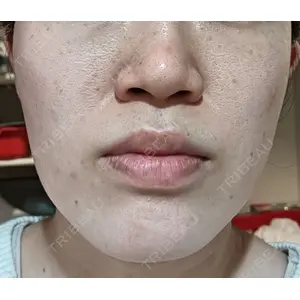 ビラビューティークリニック 博多美容外科/美容皮膚科 ビラビューティークリニック口コミ