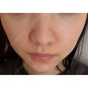 Belle Via Skin Clinic Belle Via Clinic口コミ