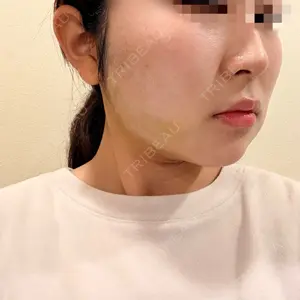 アリエル美容クリニック アリエル美容クリニック 水戸院口コミ