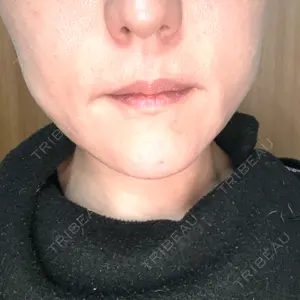 ルラ美容クリニック ルラ美容クリニック 大阪本院口コミ