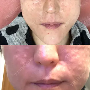 ルラ美容クリニック ルラ美容クリニック 大阪本院口コミ