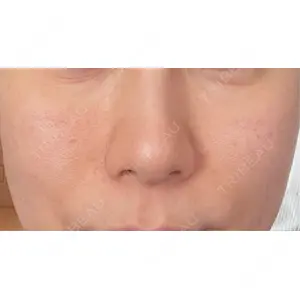 TAクリニック 新宿TAクリニック口コミ