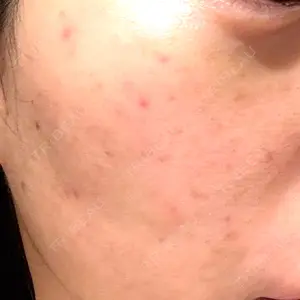 心斎橋なんばRINBEAUTYCLINIC美容皮膚科美容外科 RIN BEAUTY CLINIC口コミ