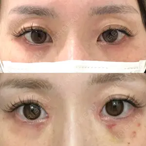 アイビークリニック 千葉美容外科アイビークリニック口コミ