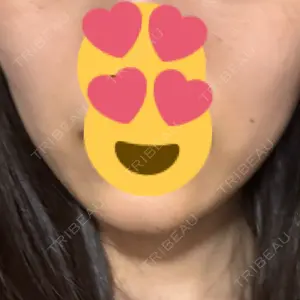 ルラ美容クリニック ルラ美容クリニック 池袋院口コミ