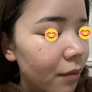 東京シルククリニック 東京シルククリニック 新宿院口コミ