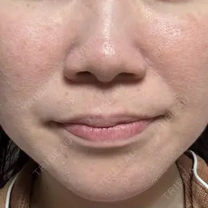 NEO Skin Clinic NEO Skin Clinic恵比寿口コミ