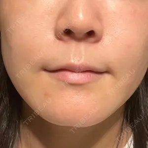 口コミ