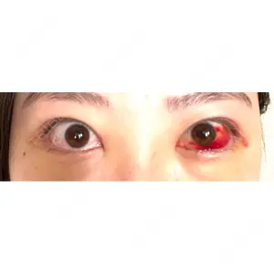 韓国ST美容整形外科口コミ