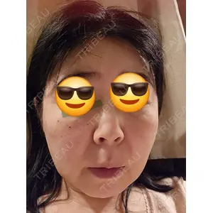 アイビークリニック 千葉美容外科アイビークリニック口コミ