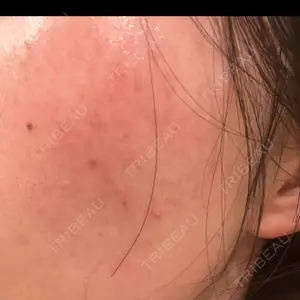 ルラ美容クリニック ルラ美容クリニック 郡山院口コミ