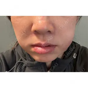 TCB東京中央美容外科 TCB東京中央美容外科 銀座有楽町院口コミ