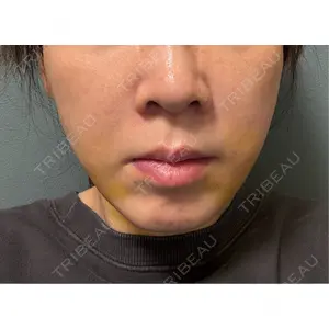 TCB東京中央美容外科 TCB東京中央美容外科 銀座有楽町院口コミ