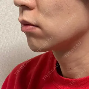 ビラビューティークリニック 博多美容外科/美容皮膚科 ビラビューティークリニック口コミ