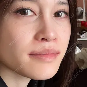 銀座マイアミ美容外科口コミ