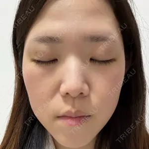 Nebula Clinic 小倉美容外科ネビュラクリニック口コミ