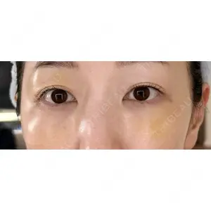 セオリークリニック口コミ