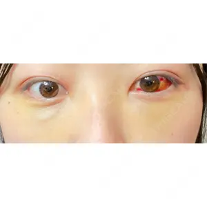 韓国ST美容整形外科口コミ